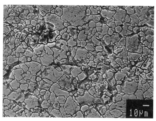 hien-tuong-an-mon-lien-tinh-the